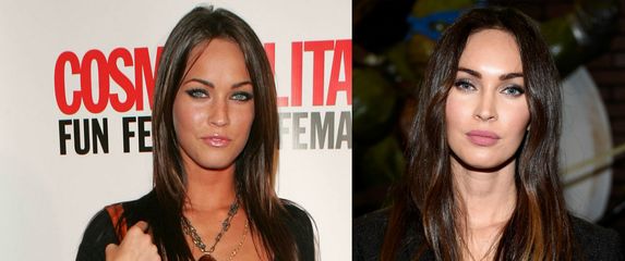 Nekad i sad: Slavne žene koje su povećale usne - 1