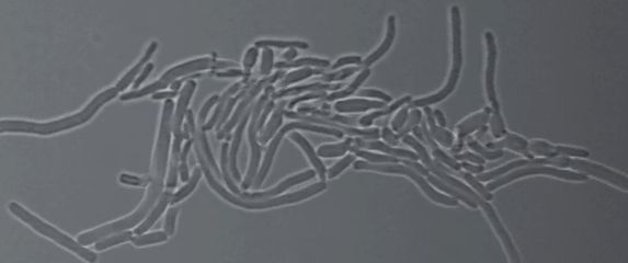 Bakterija Corynebacterium matruchotii