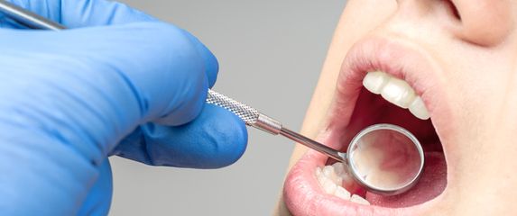 Pregled usne šupljine, ilustracija