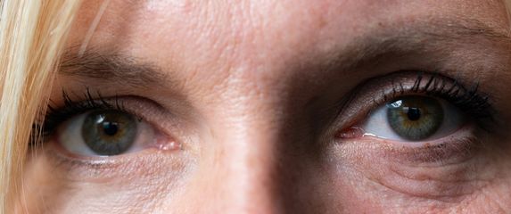 Testirale smo L'Oréal Paris Revitalift Laser kremu za instant-korekciju vrećica ispod očiju