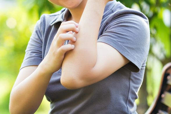 Ubod komarca mogu olakšati brojni pomagači