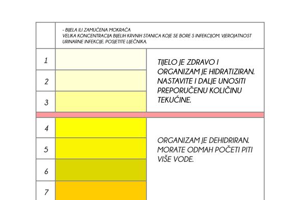 Boja mokraće otkriva stanje organizma