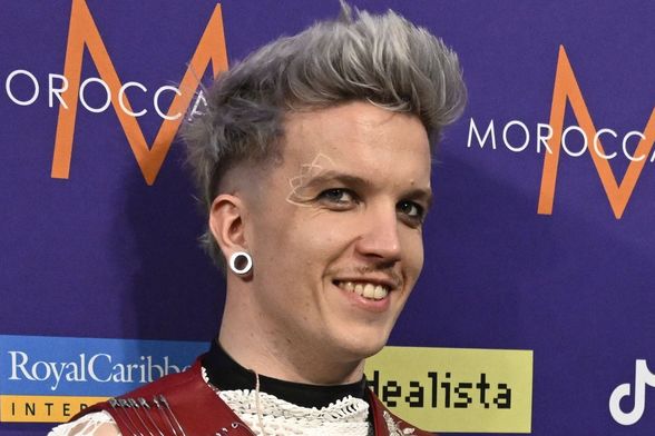 Baby Lasagna kod oka ima lažnu bijelu tetovažu