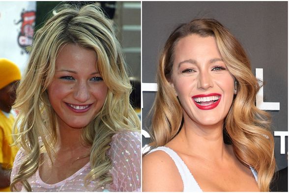 Blake Lively