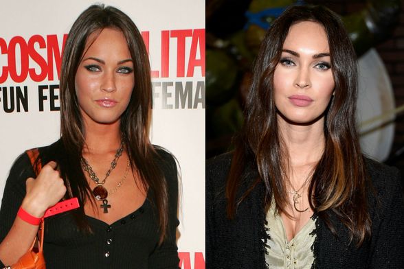 Nekad i sad: Slavne žene koje su povećale usne - 1