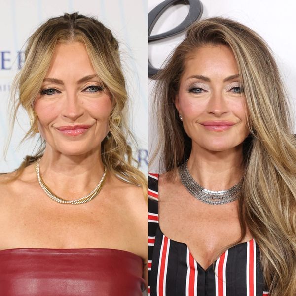 Facelift: Poznate žene koje su bile na zatezanju lica