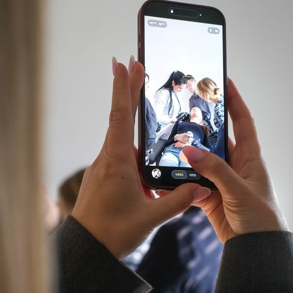 Proljetni reset kože: Zašto su polinukleotidi postali omiljeni tretman za prirodan sjaj?