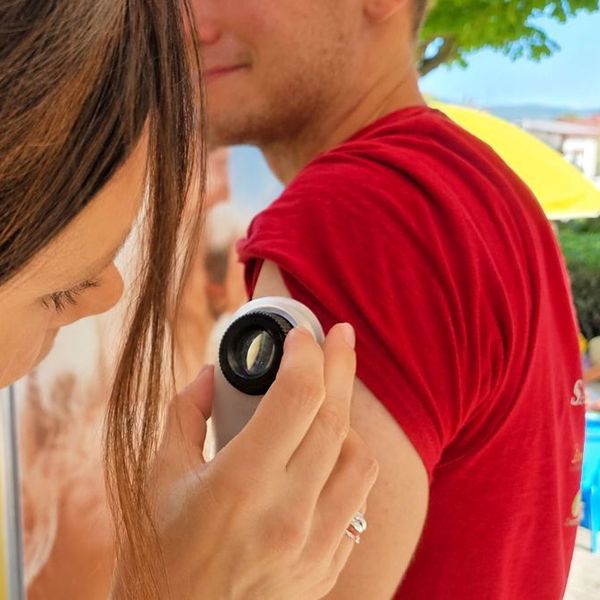 Više od 3.000 ljudi besplatno pregledalo kožu u dosad najvećoj inicijativi dm-a