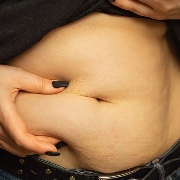 Ovo je jedina kombinacija koja dokazano topi najopasniju masnoću u tijelu!