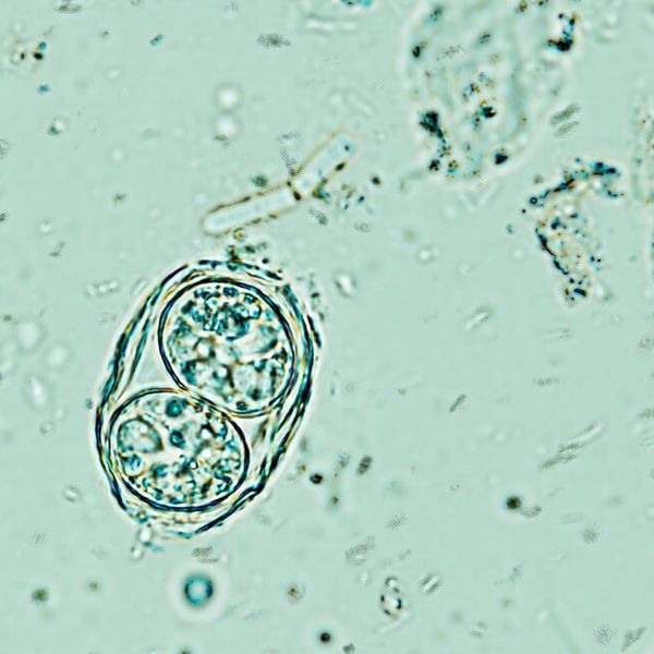 Ovaj parazit ima trećina ljudi, a znanstvenici tek sada shvaćaju koliko je opasan!