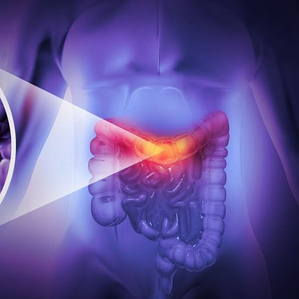 Čak 91 % veći rizik od raka debelog crijeva: Ova navika može vas skupo stajati!
