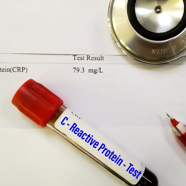 Hrana koja smanjuje CRP: Što jesti da upala prođe prirodnim putem?