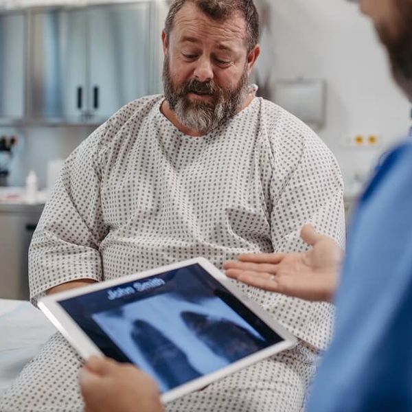 Koliko se živi s rakom pluća? Ovo su stvarne šanse za preživljenje po stadijima bolesti