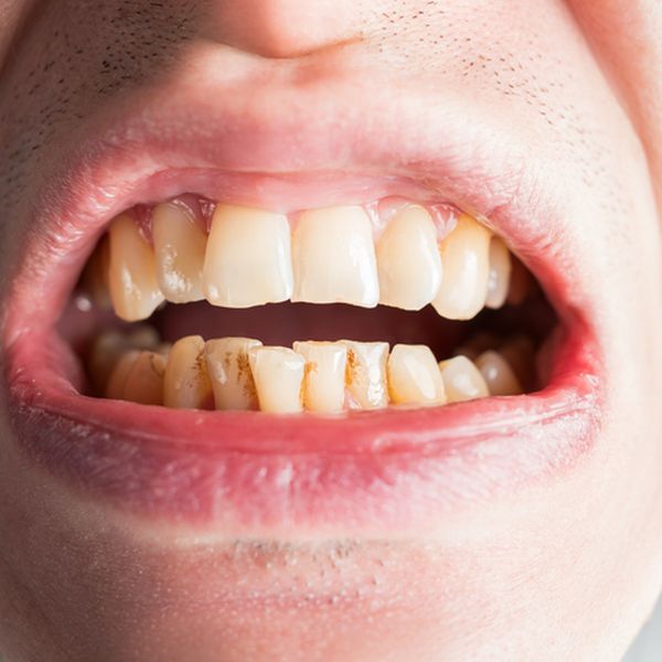 Želite doživjeti duboku starost? Tajna se skriva u vašim ustima