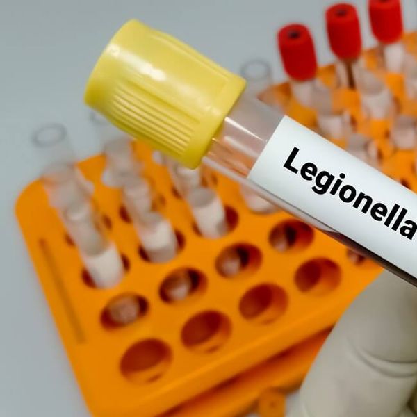 Legionarska bolest (legionela) na Rebru! Ovo su simptomi