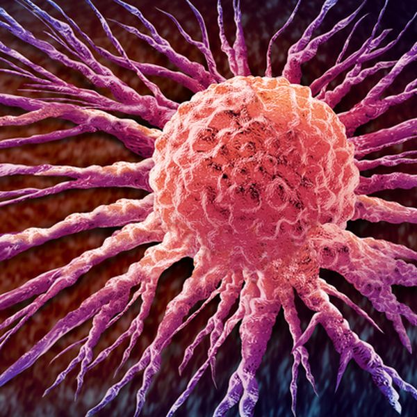 Ove dvije generacije sve češće obolijevaju od rijetkog oblika raka čiji se simptomi lako mogu krivo interpretirati