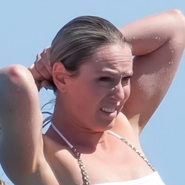 Lindsey Vonn pokazala ožiljak od operacije