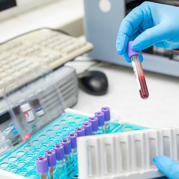 Marker za rak debelog crijeva: Ovaj krvni nalaz može otkriti puno više nego što mislite