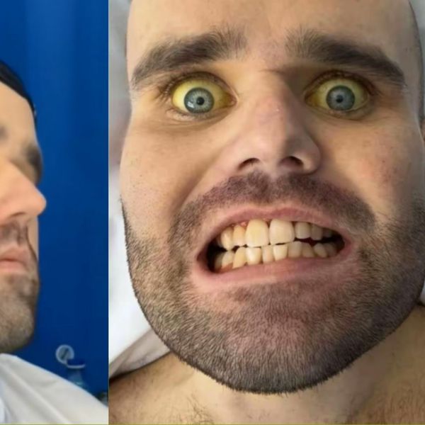 Pio je po šest boca vina dnevno, a sada dijeli stravičan utjecaj koji je imalo na njegovo zdravlje