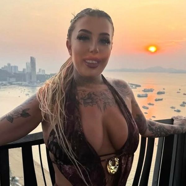 Britanska turistkinja Beth Klug bori se za život nakon stravičnog pada s hotelskog balkona