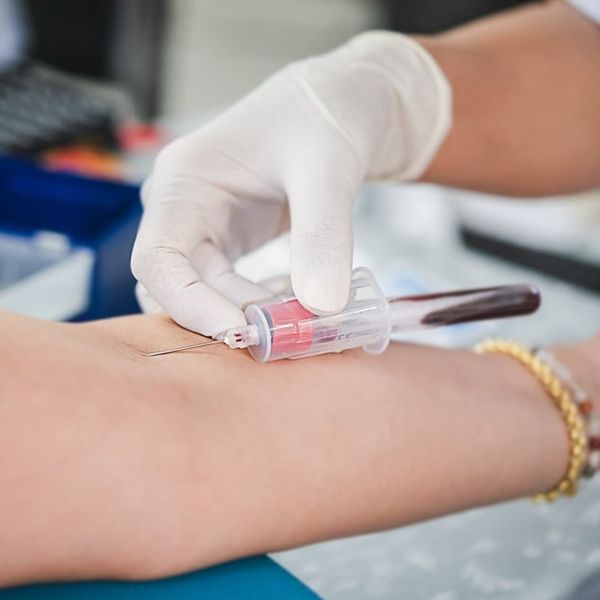 5 ključnih novosti koje morate znati o novim smjernicama za kolesterol