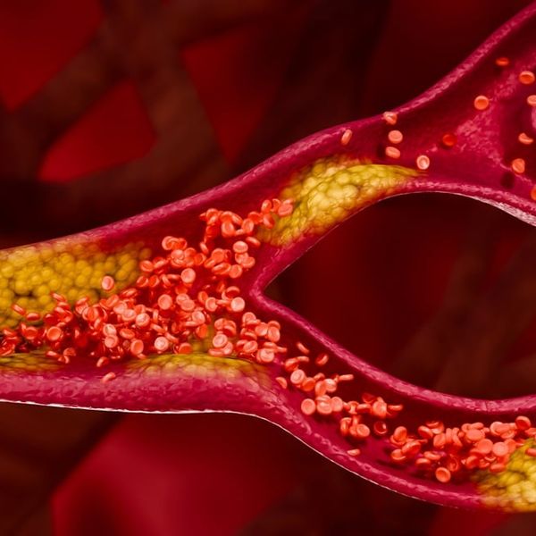 10 rizičnih pogrešaka vezanih uz kolesterol koje trebate izbjegavati ako imate više od 50 godina