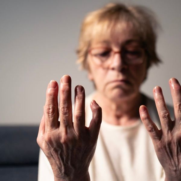 Reumatoidni artritis i životni vijek: 5 opasnih komplikacija koje mogu biti kobne