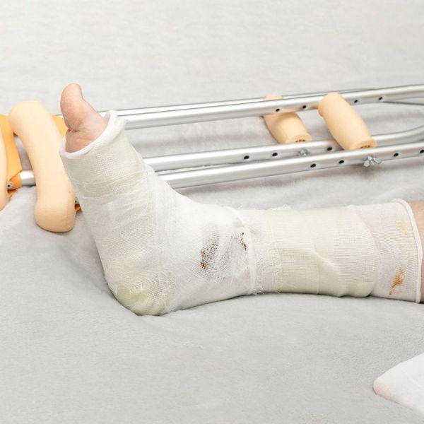 Postoji neobična teorija o ljudima koji nikada nisu slomili kost! Jeste li o tome razmišljali?