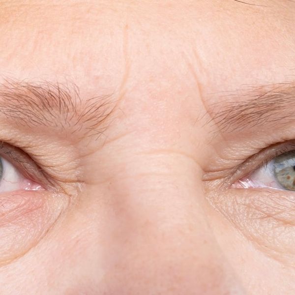 4 promjene na licu koje mogu značiti da ne unosite dovoljno proteina