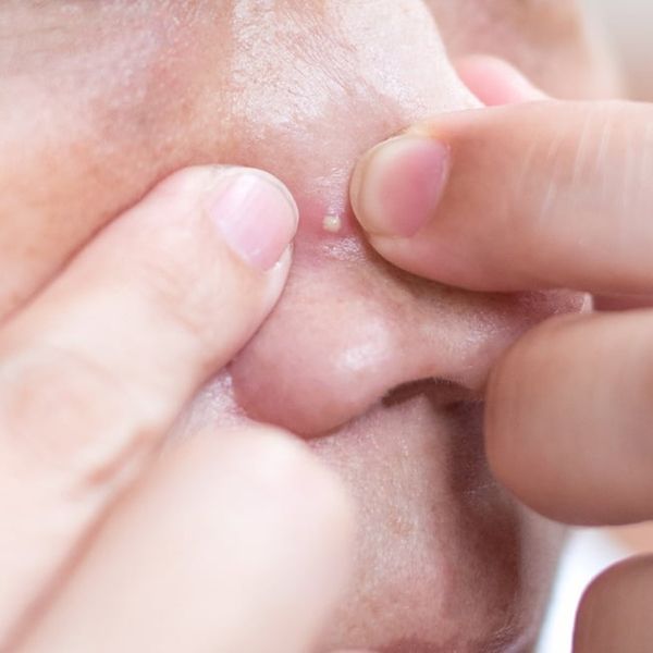 Ovo područje na licu nikada ne smijete dirati – evo zašto ga zovu “trokut smrti”!