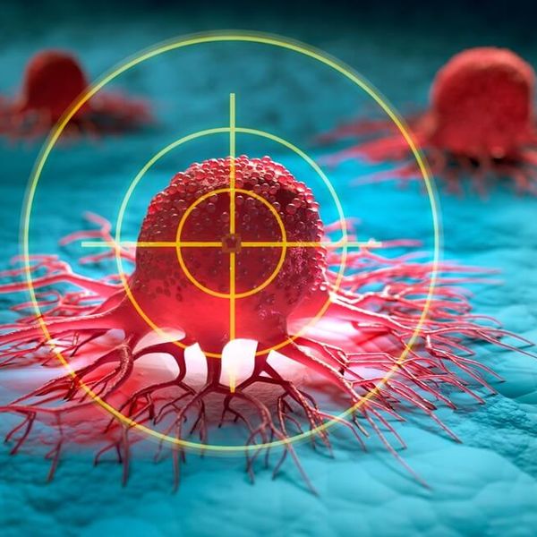 Najgori karcinomi: 5 najpodmuklijih vrsta raka koje gotovo nitko ne prepozna dok nije prekasno