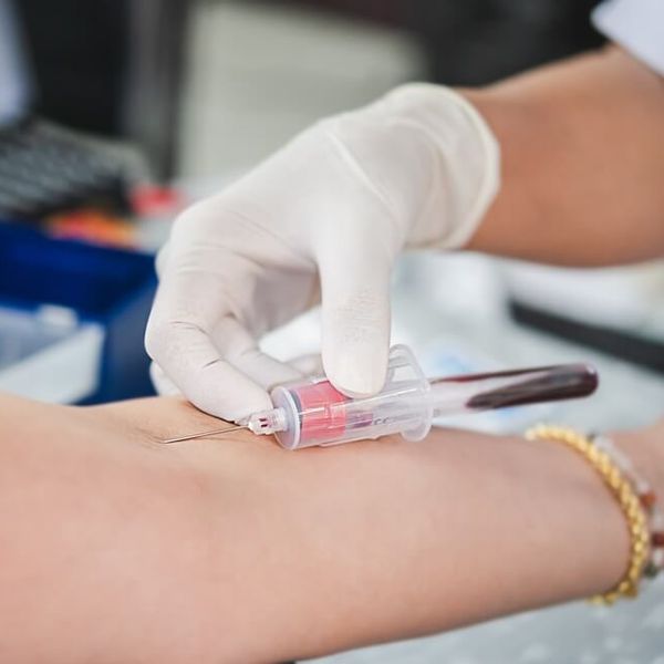 6 simptoma zbog kojih trebate odmah napraviti krvne pretrage