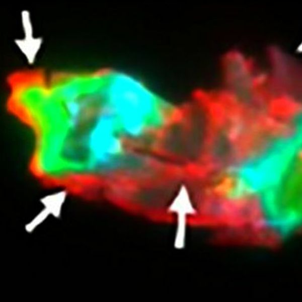Otkriven ključ trajnih simptoma dugog COVID-a