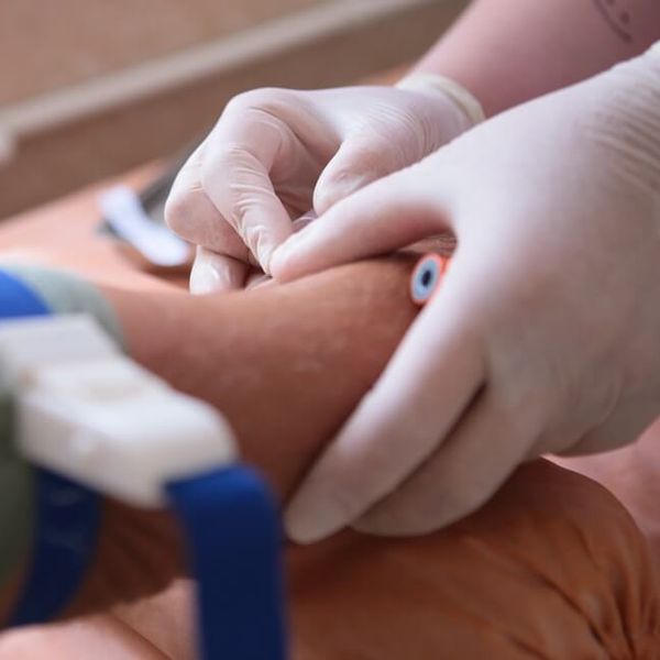 Jedan tihi pokazatelj u krvi može predvidjeti demenciju desetljećima prije simptoma!