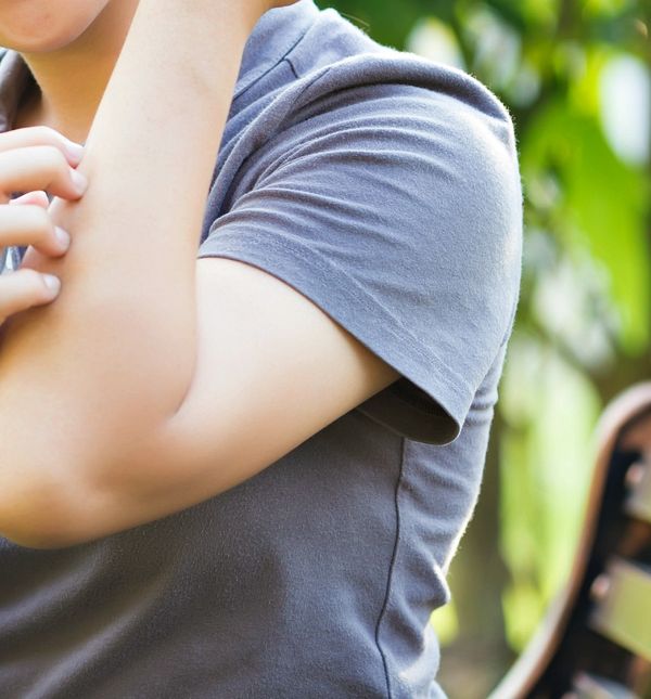 Ubod komarca mogu olakšati brojni pomagači