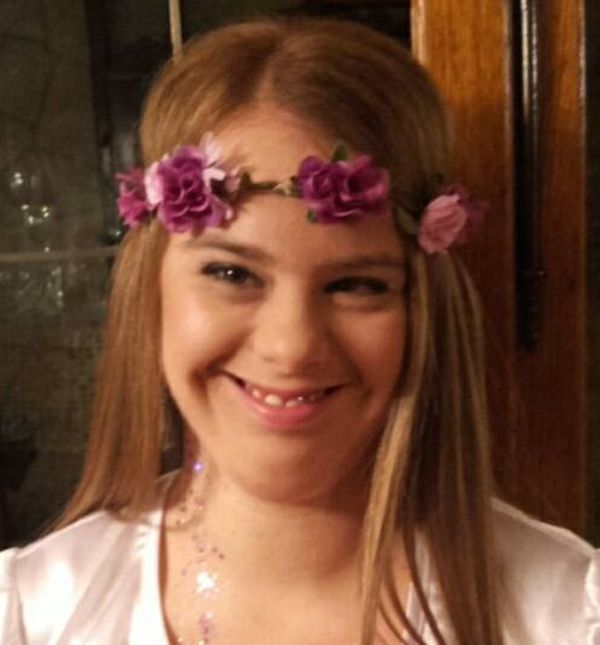 Aurora je rođena s Down sindromom