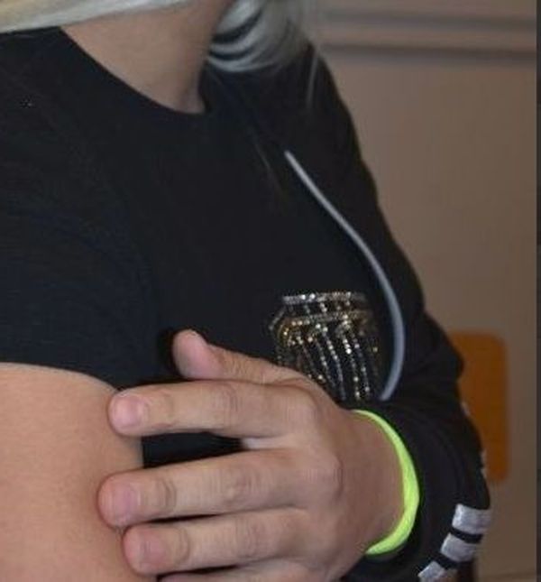 Učenik u Zadru užarenim predmetom u obliku slova U žigosao kolegicu (Foto: Arif Sitnica/Zadarski.hr)