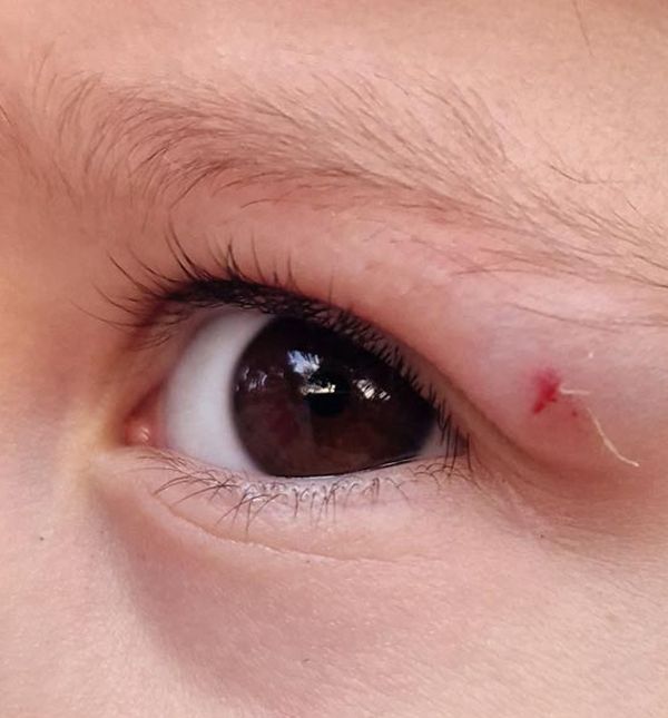 Dijete će ponekad pasti i to je dio odrastanja