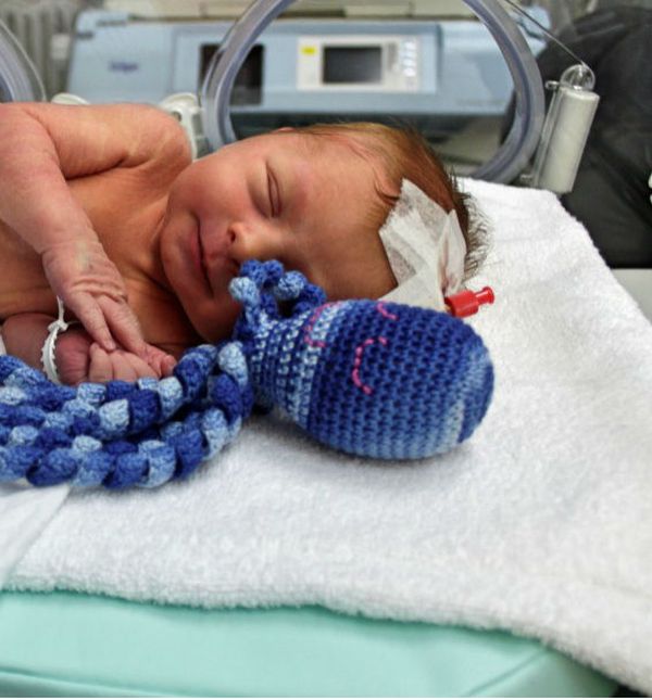 Opća bolnica Virovitica je među prvima u Hrvatskoj koja bebama nudi hobotnicu za smirenje i utjehu