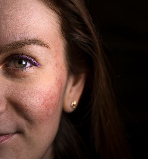 Uskoro rozaceja i ja punimo pet zajedničkih godina