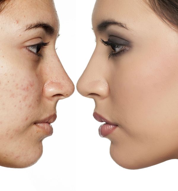 Lice žene prije i poslije nanošenja tekućeg pudera