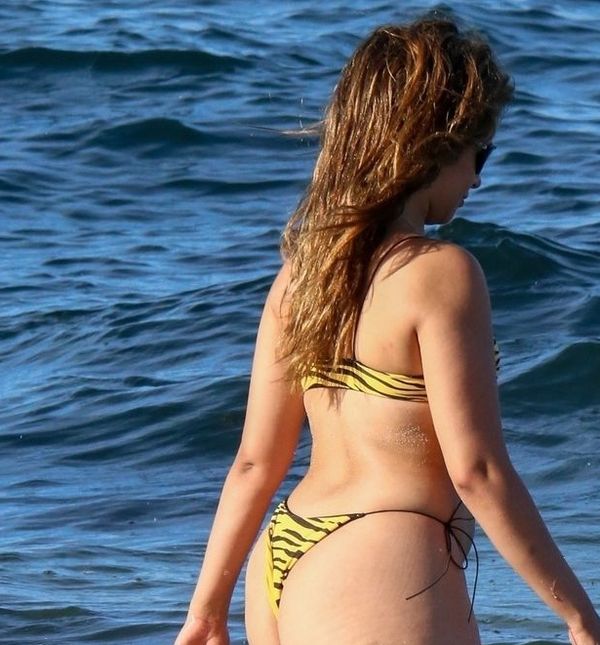 Celulit i strije sastavni su dio ženskog tijela i ne bi trebali utjecati na samopouzdanje