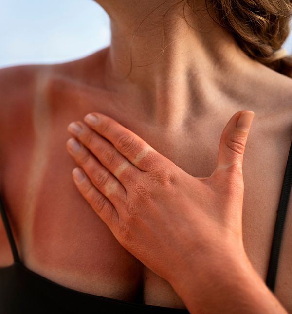 Potrudite se da do ovoga ne dođe