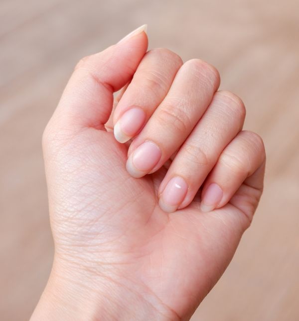 Bijele mrlje na noktima pokazatelj su brojnih promjena u organizmu