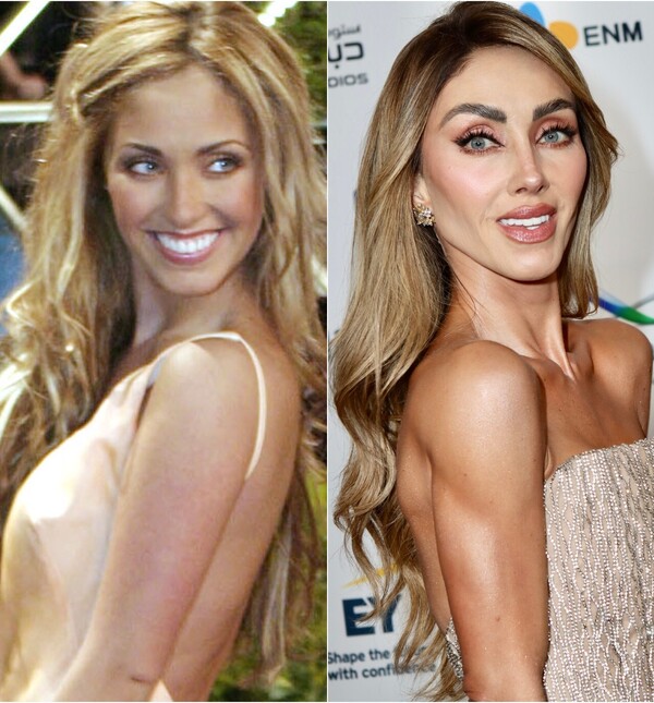 Anahi