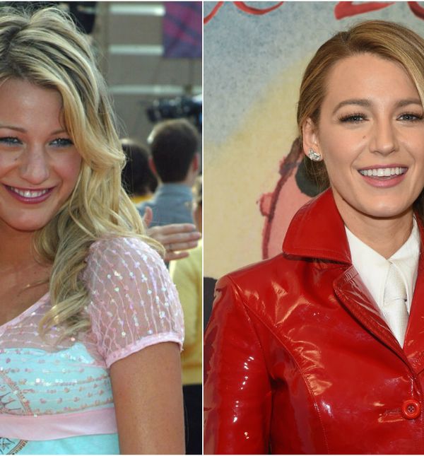 Nos Blake Lively danas izgleda drugačije, ali glumica nikad nije priznala da ga je korigirala