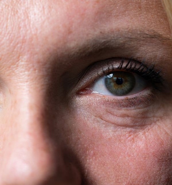 Mogu li vrećice ispod očiju zaista nestati u samo 15 minuta?