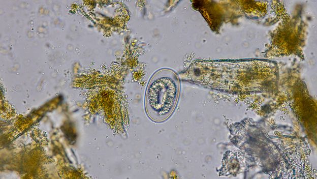 Jajašce parazita u uzorku stolice,ilustracija