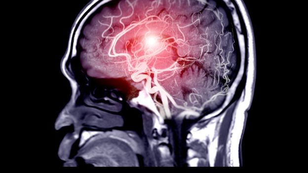 Snimka čovjekova mozga, ilustracija