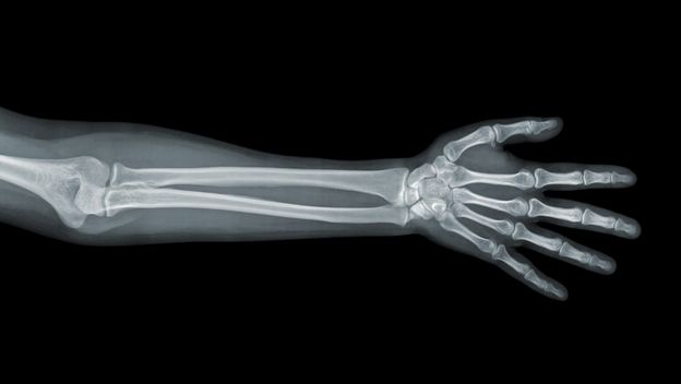 Rentgenska snimka podlaktice, ilustracija